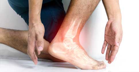 درد پاشنه پا