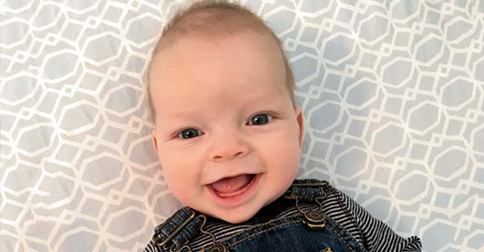 اسکافوسفالی 2