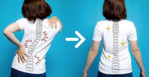 تمرین اسکولیوز