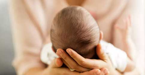 سندرم سر صاف