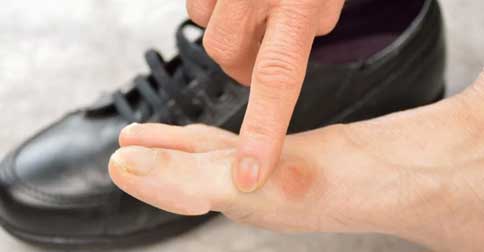 مشکل-رایج-پا