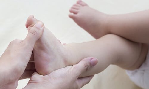 پا چنبری چیست و چگونه درمان می‌شود؟