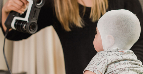 ارتوز کرانیال