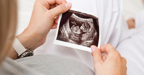 سونوگرافی دوران بارداری: جنین دولیکوسفال است
