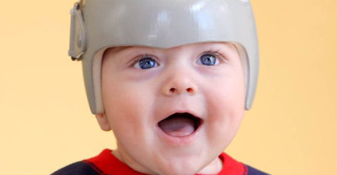 بهترین سن نوزاد برای دریافت کلاه فرم دهی جمجمه