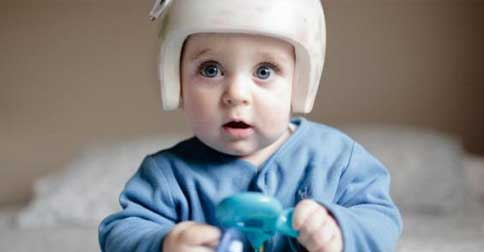 کلاه فرم دهی جمجمه