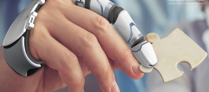 قیمت پروتز دست