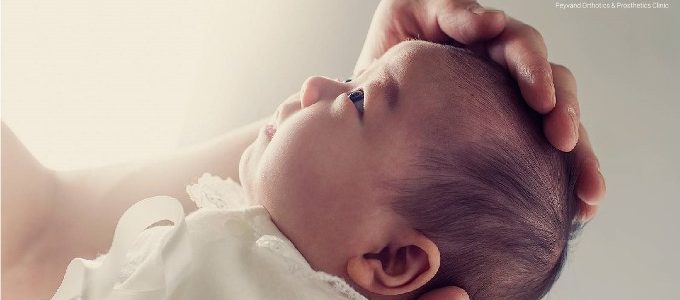 فرورفتگی پشت سر نوزاد