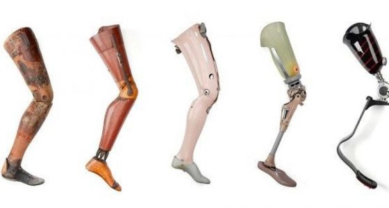 تکنولوژی های جدید در ساخت پای مصنوعی